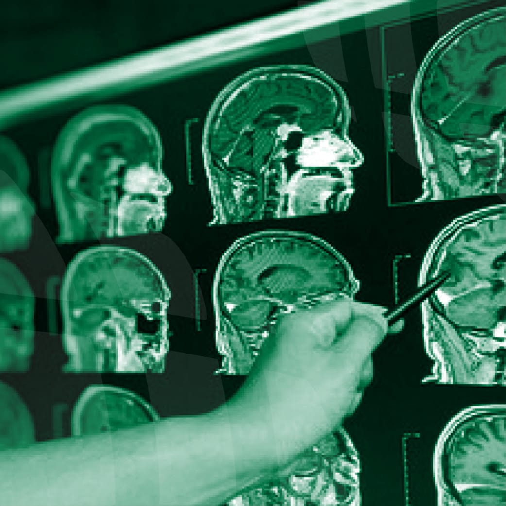High-end Imaging in TBI