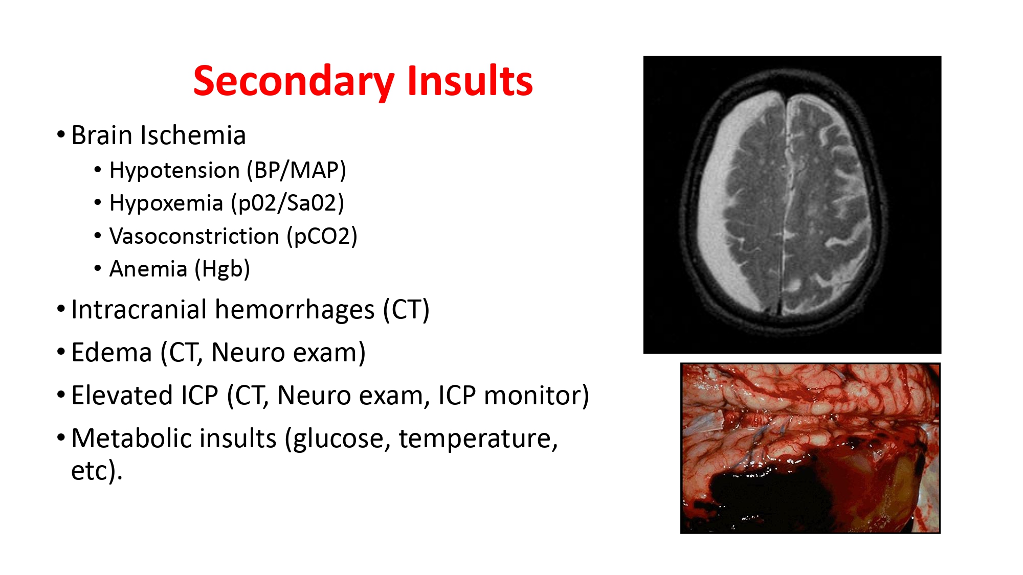DO NGOC SON - Prehospital management of head trauma patients.pptx_page-0018