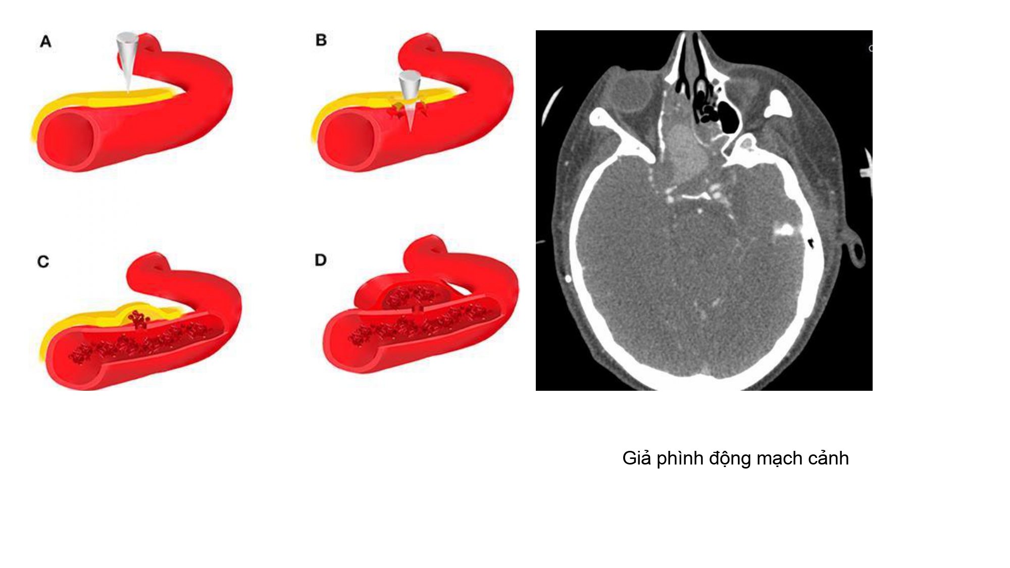 Nguyen Ngoc Cuong.pptx_page-0005