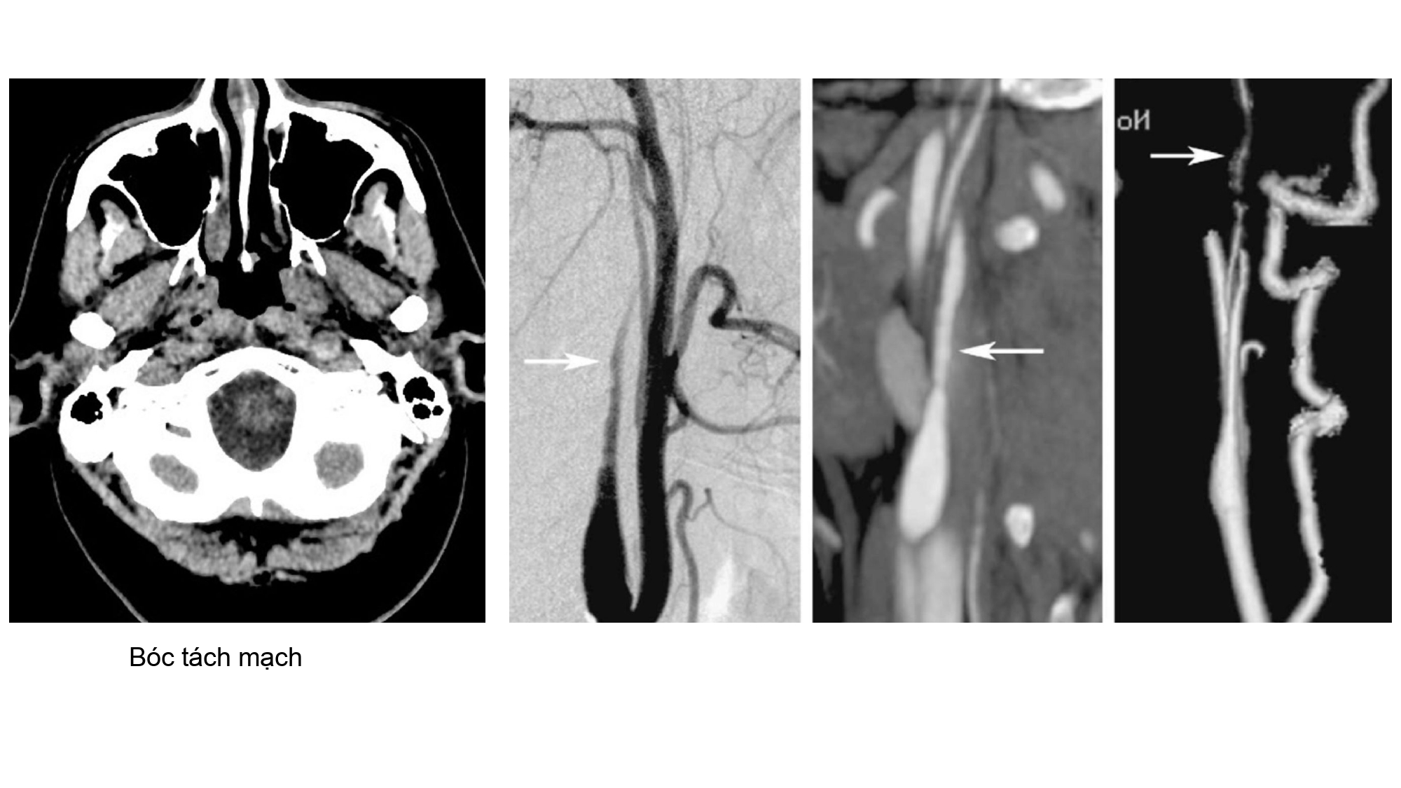 Nguyen Ngoc Cuong.pptx_page-0006