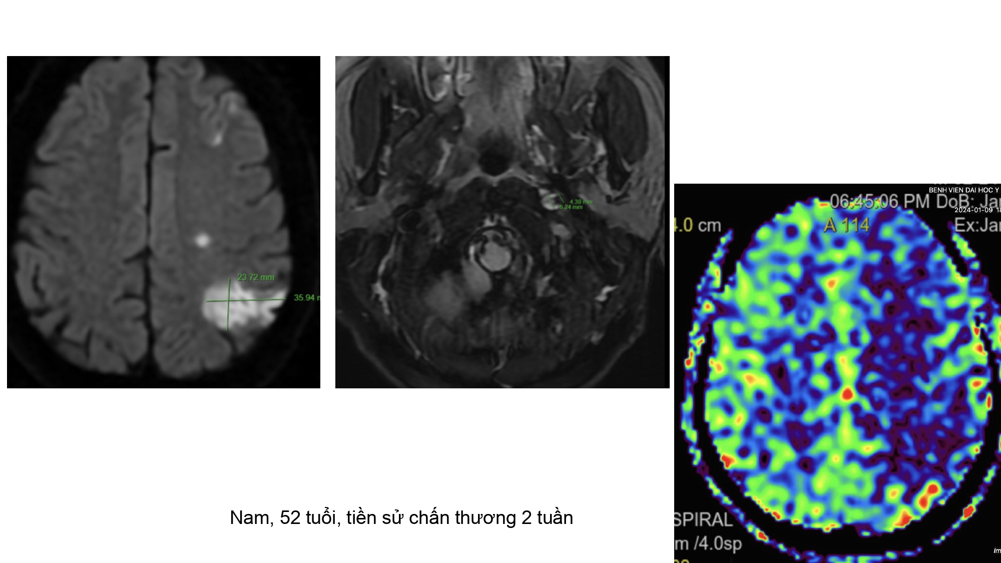 Nguyen Ngoc Cuong.pptx_page-0009