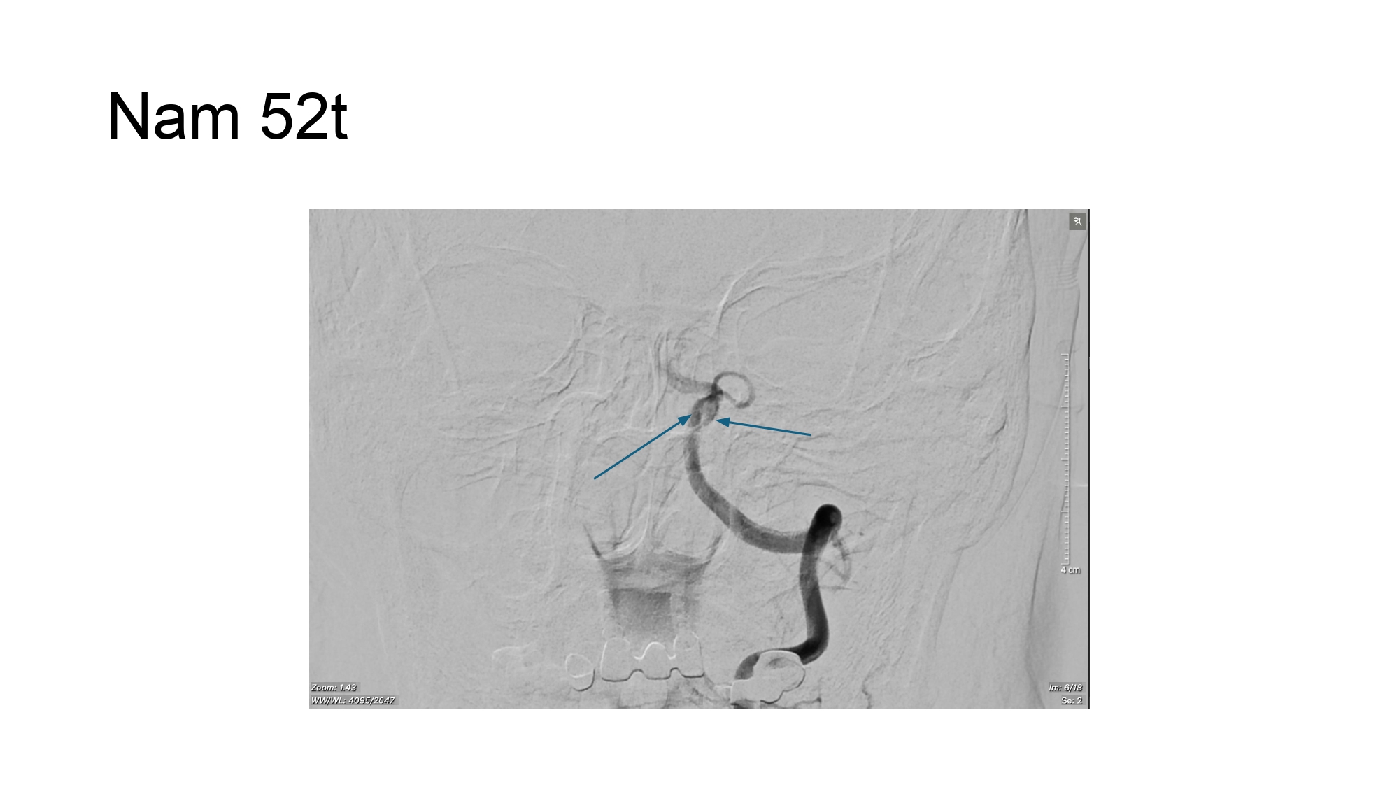 Nguyen Ngoc Cuong.pptx_page-0013