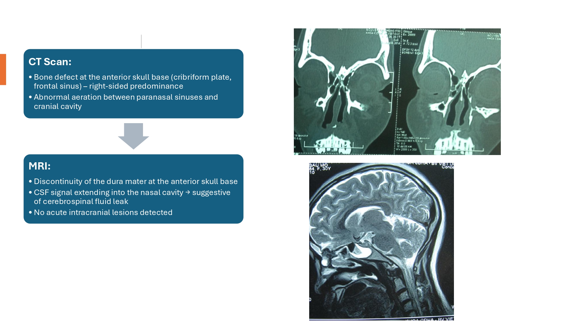 Nguyen Thanh Xuan_page-0004