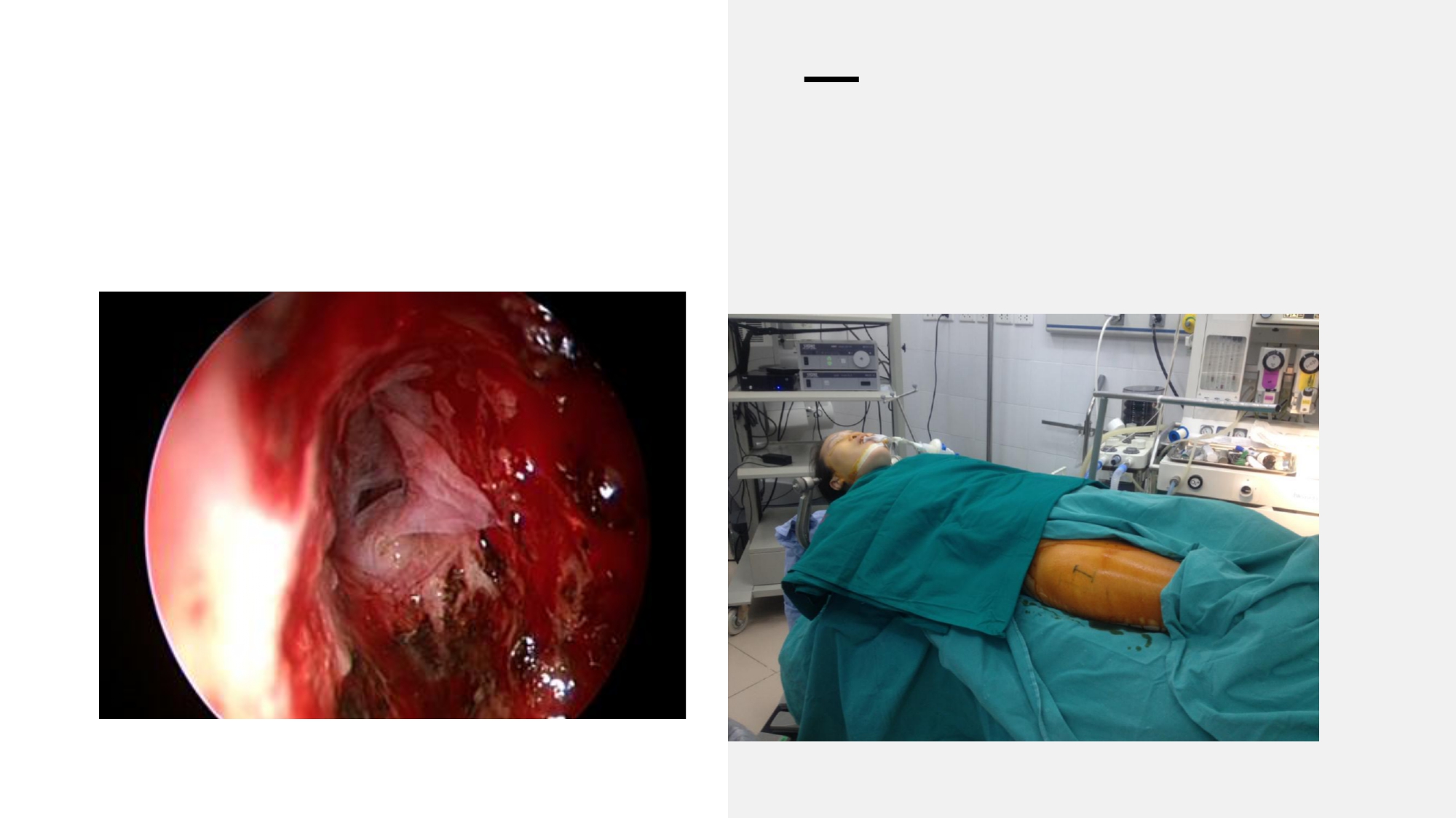 Nguyen Thanh Xuan_page-0006