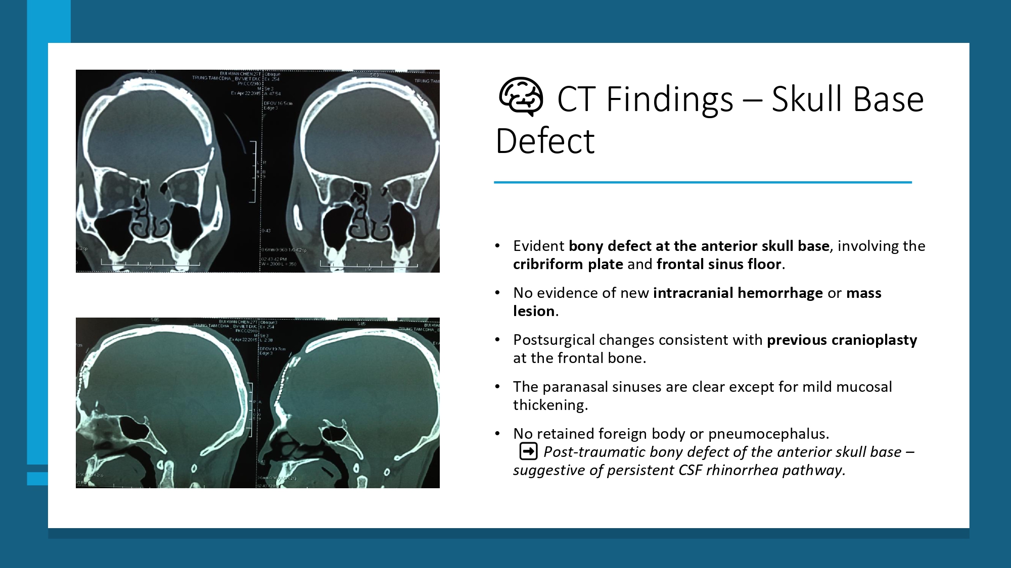 Nguyen Thanh Xuan_page-0009