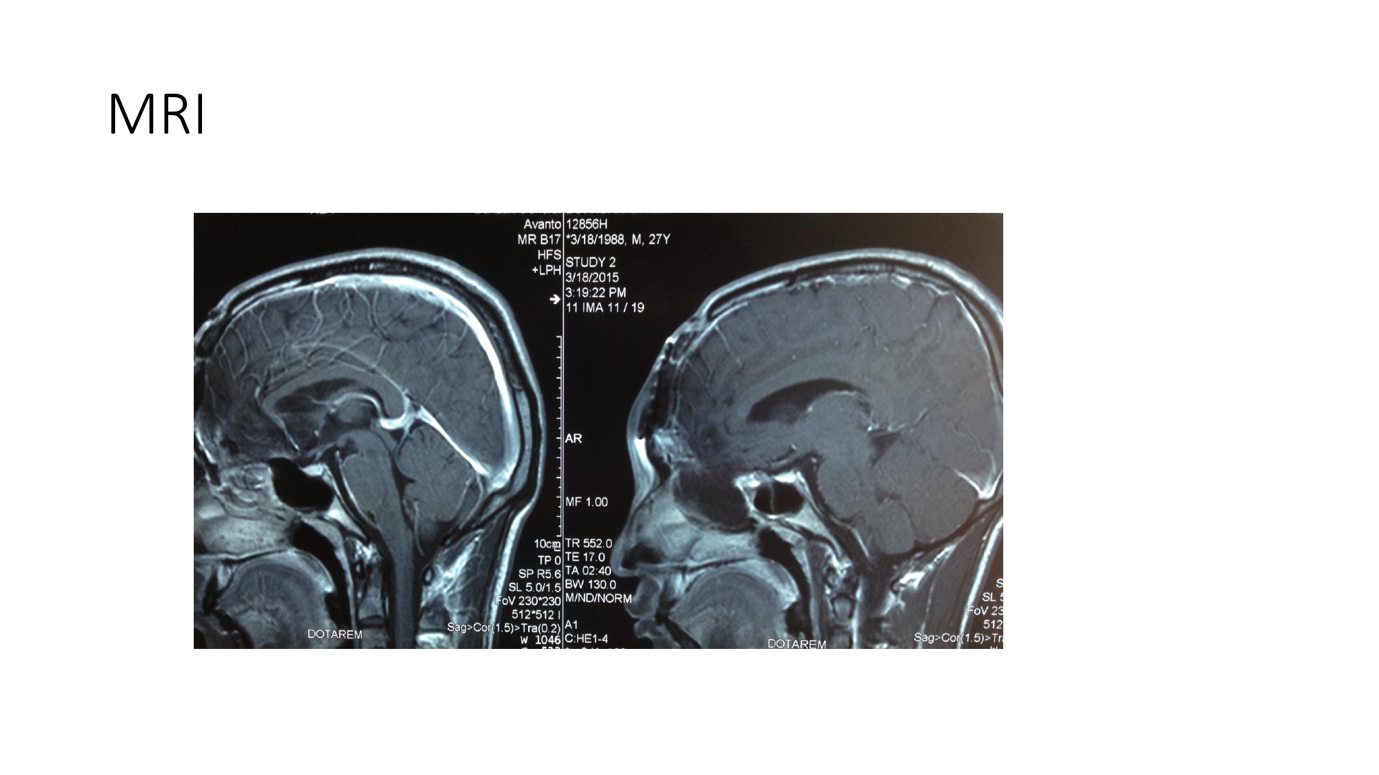 Nguyen Thanh Xuan_page-0010