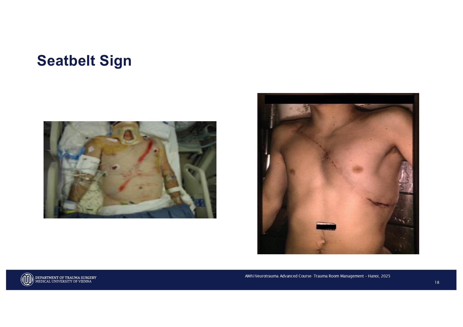 2025_ Polytrauma Vortrag Hanoi AMN - Treatment considerations Polytrauma_page-0015