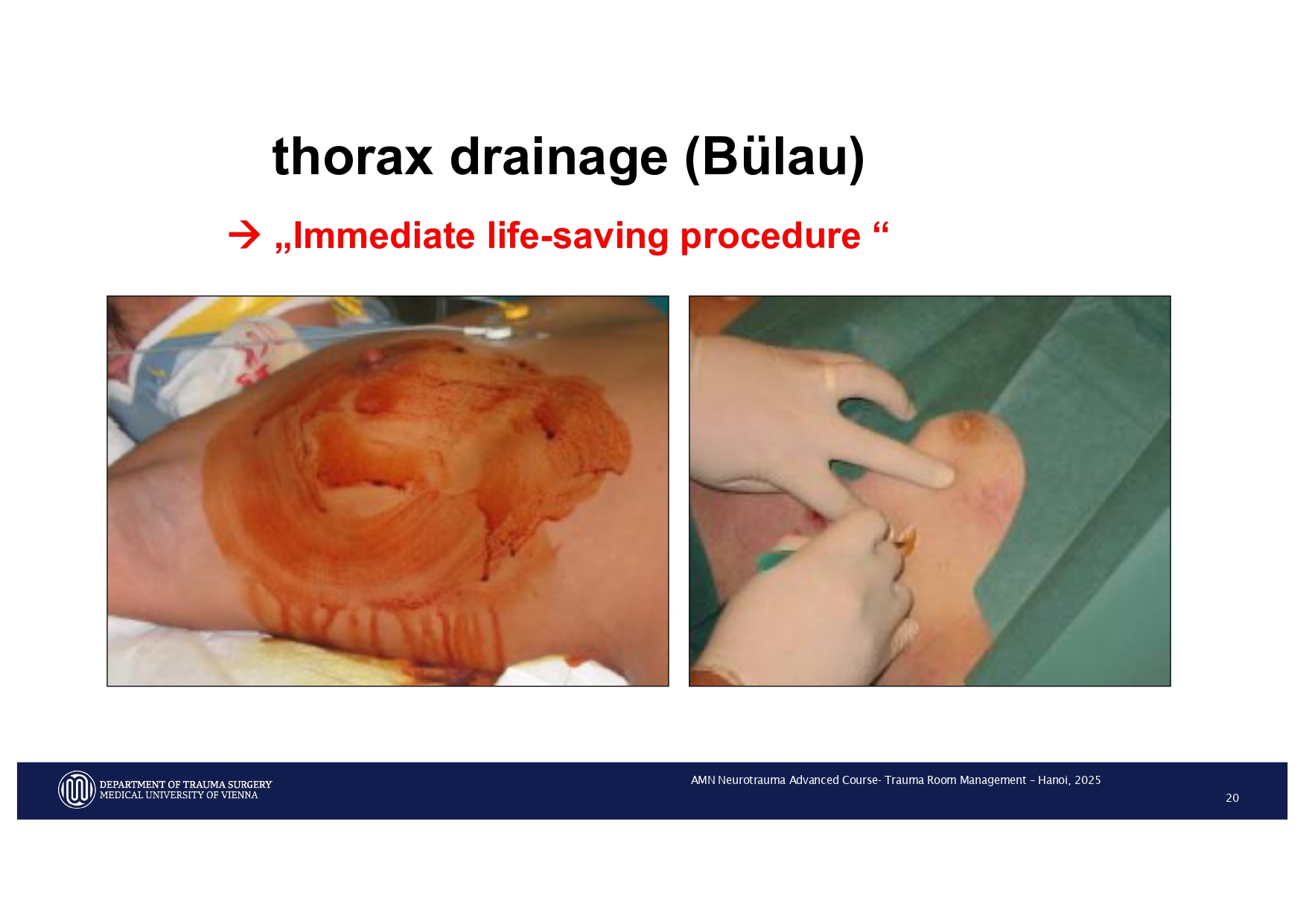 2025_ Polytrauma Vortrag Hanoi AMN - Treatment considerations Polytrauma_page-0017