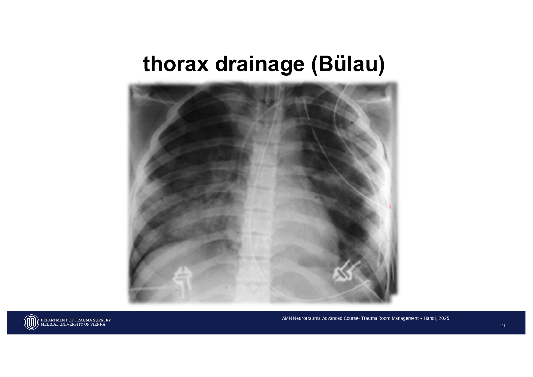 2025_ Polytrauma Vortrag Hanoi AMN - Treatment considerations Polytrauma_page-0018