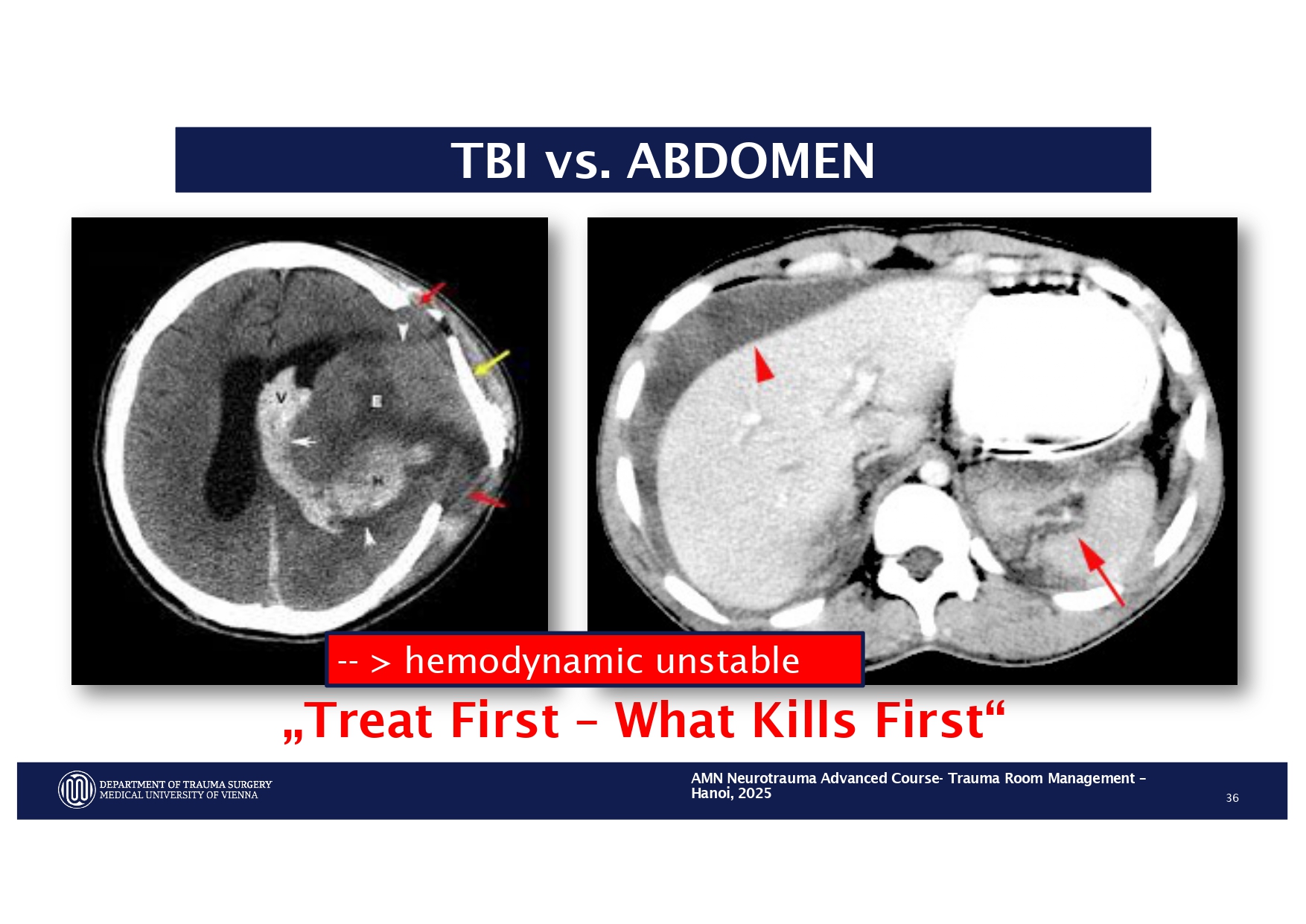 2025_ Polytrauma Vortrag Hanoi AMN - Treatment considerations Polytrauma_page-0026
