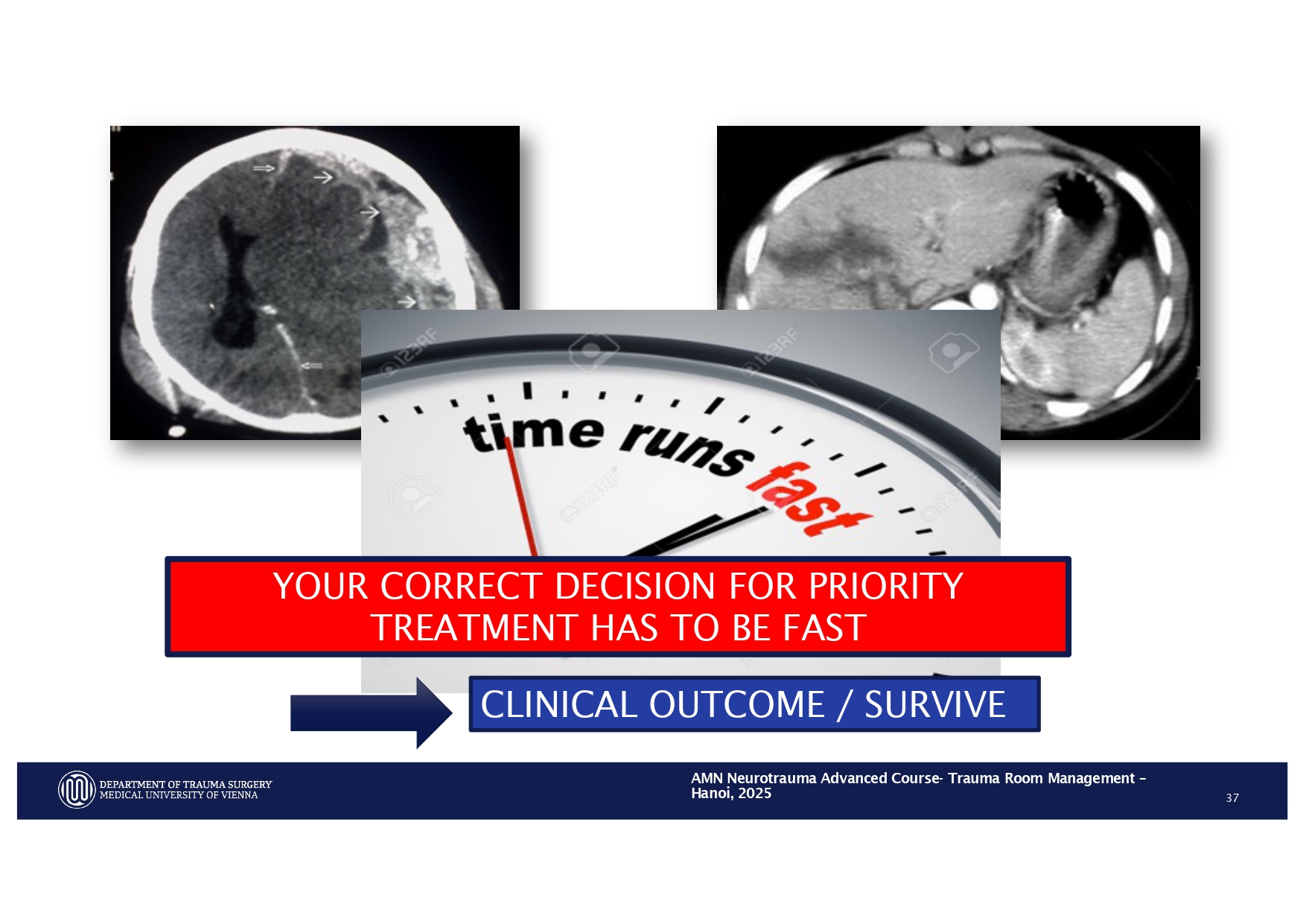 2025_ Polytrauma Vortrag Hanoi AMN - Treatment considerations Polytrauma_page-0027