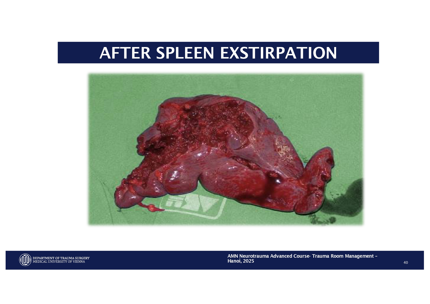 2025_ Polytrauma Vortrag Hanoi AMN - Treatment considerations Polytrauma_page-0030