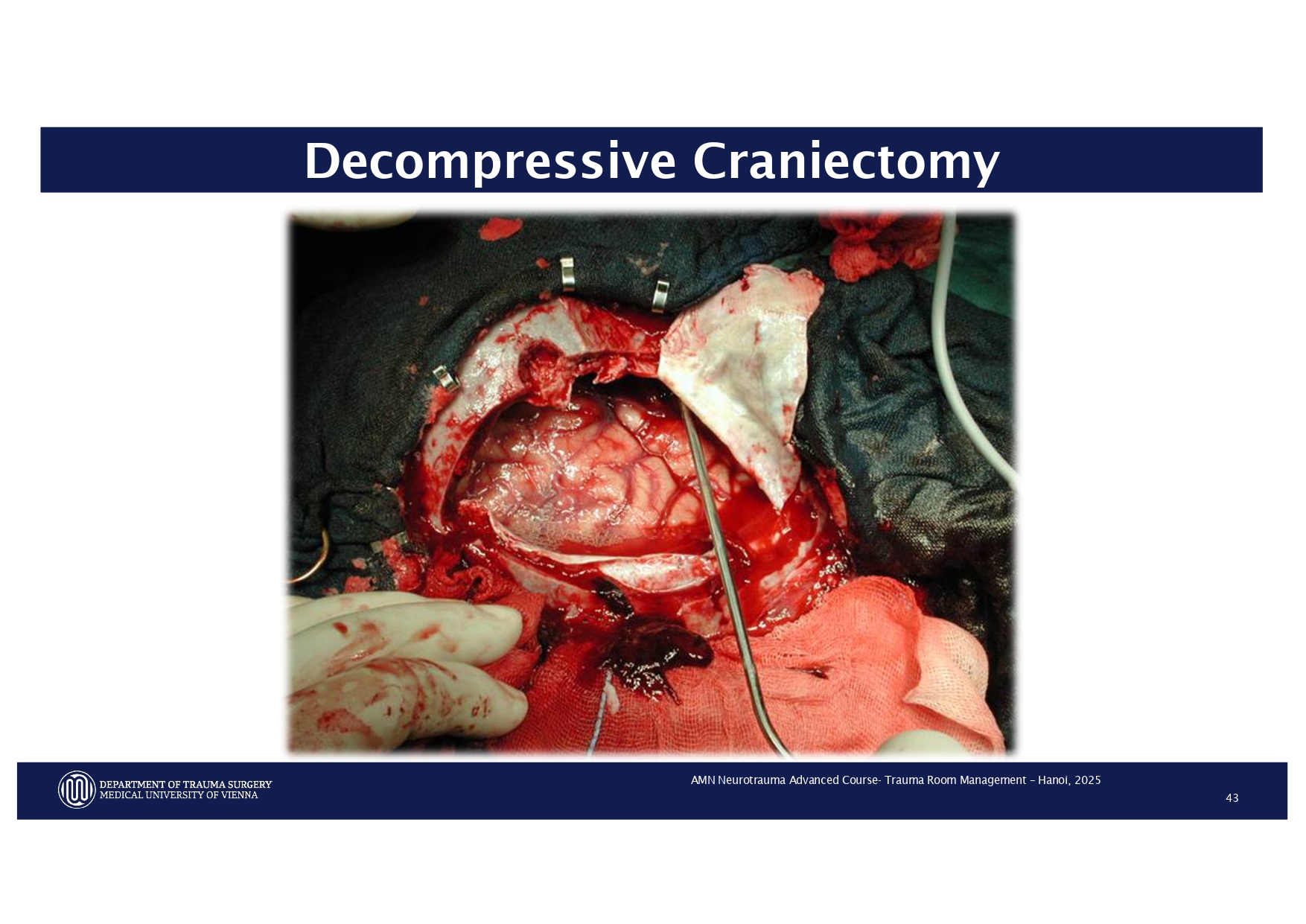 2025_ Polytrauma Vortrag Hanoi AMN - Treatment considerations Polytrauma_page-0033