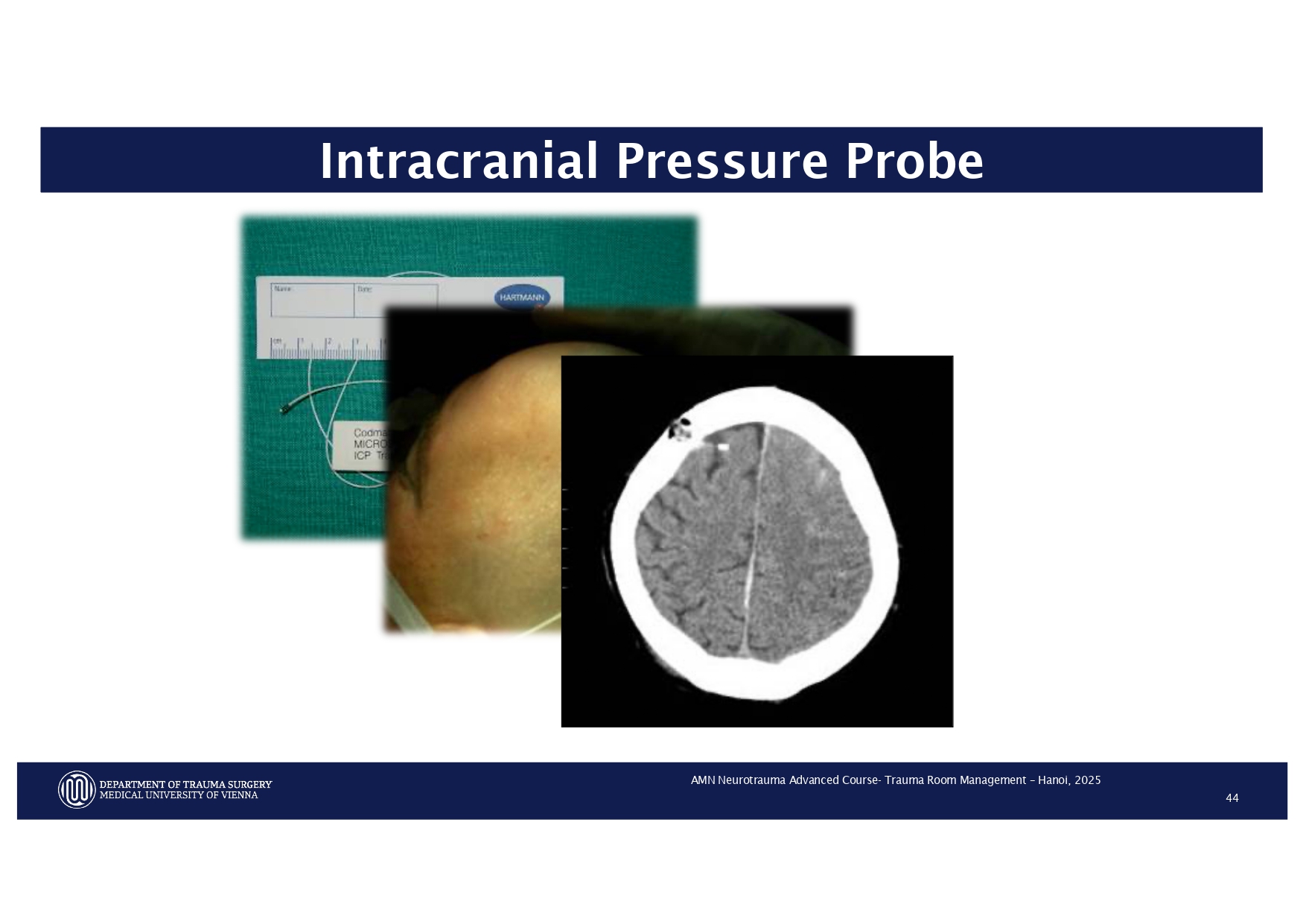 2025_ Polytrauma Vortrag Hanoi AMN - Treatment considerations Polytrauma_page-0034