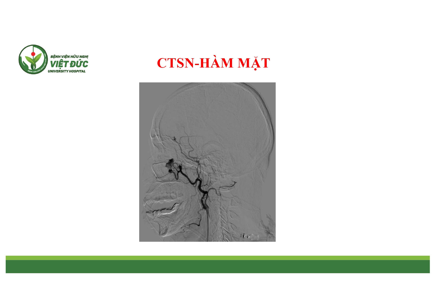 CASE LA╠éM SA╠ÇNG CHA╠é╠üN THU╠øO╠øNG SO╠ú NA╠âO VA╠Ç HA╠ÇM MA╠ú╠éT 4.11.2025 (1)_page-0004