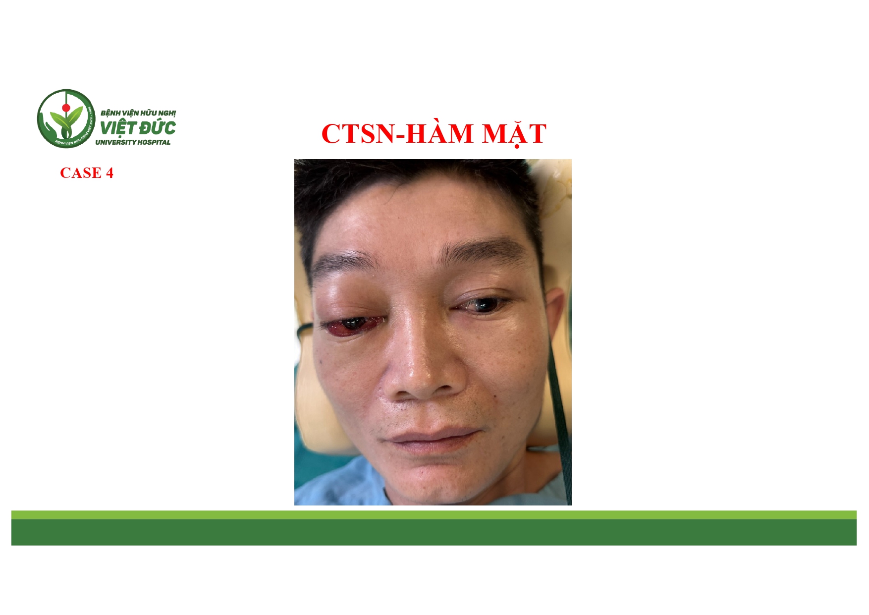 CASE LA╠éM SA╠ÇNG CHA╠é╠üN THU╠øO╠øNG SO╠ú NA╠âO VA╠Ç HA╠ÇM MA╠ú╠éT 4.11.2025 (1)_page-0009