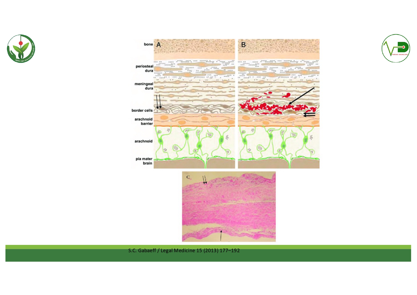 CSDH 4.11.2025 (Lê Thanh Dũng)_page-0005