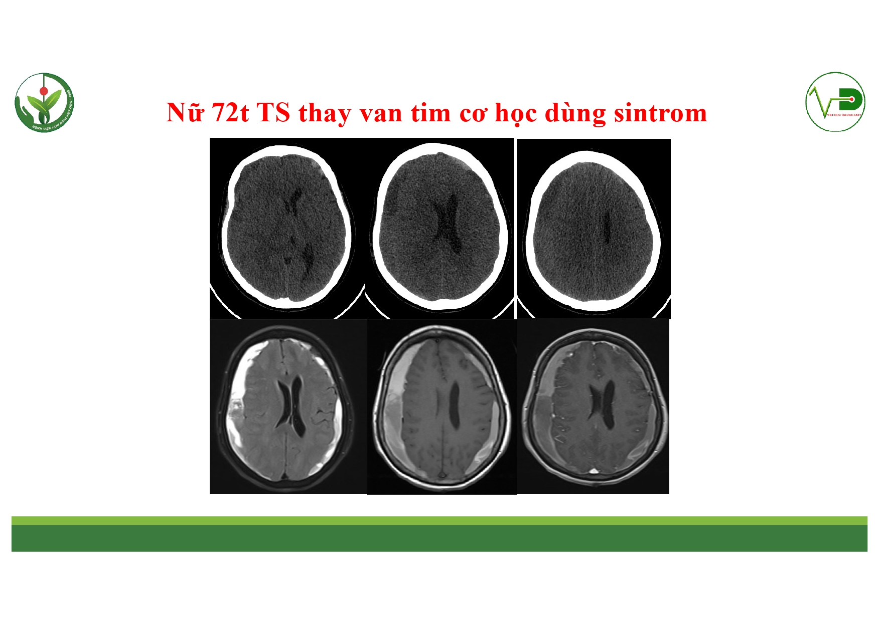 CSDH 4.11.2025 (Lê Thanh Dũng)_page-0027