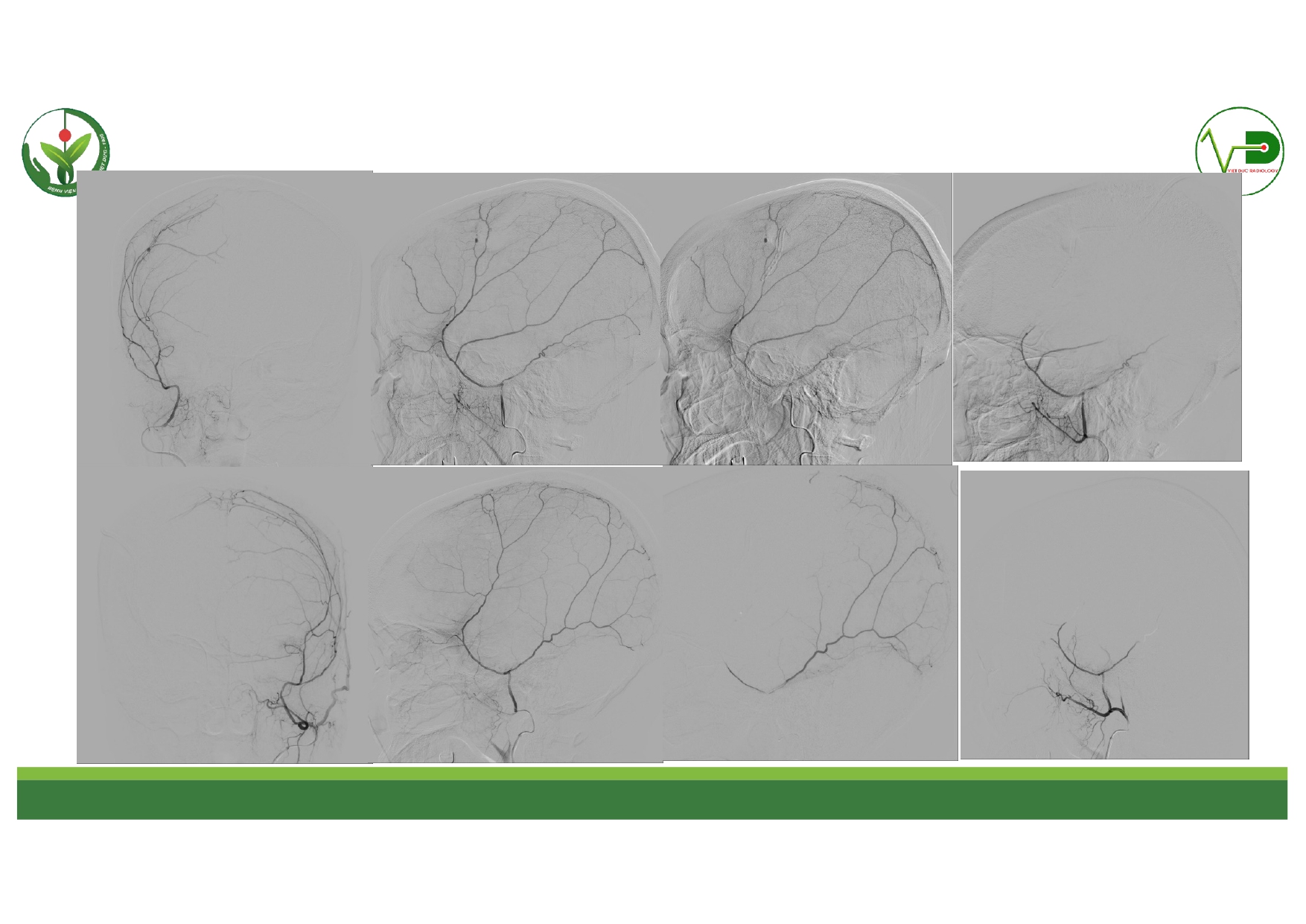 CSDH 4.11.2025 (Lê Thanh Dũng)_page-0028