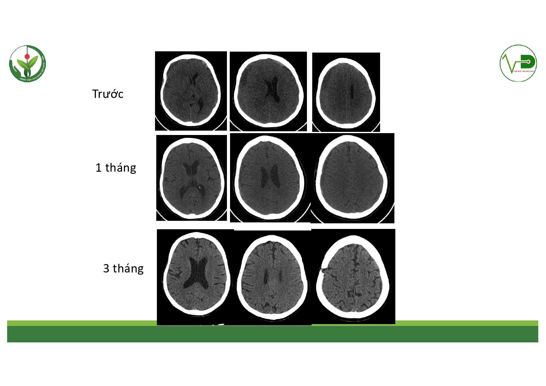 CSDH 4.11.2025 (Lê Thanh Dũng)_page-0029