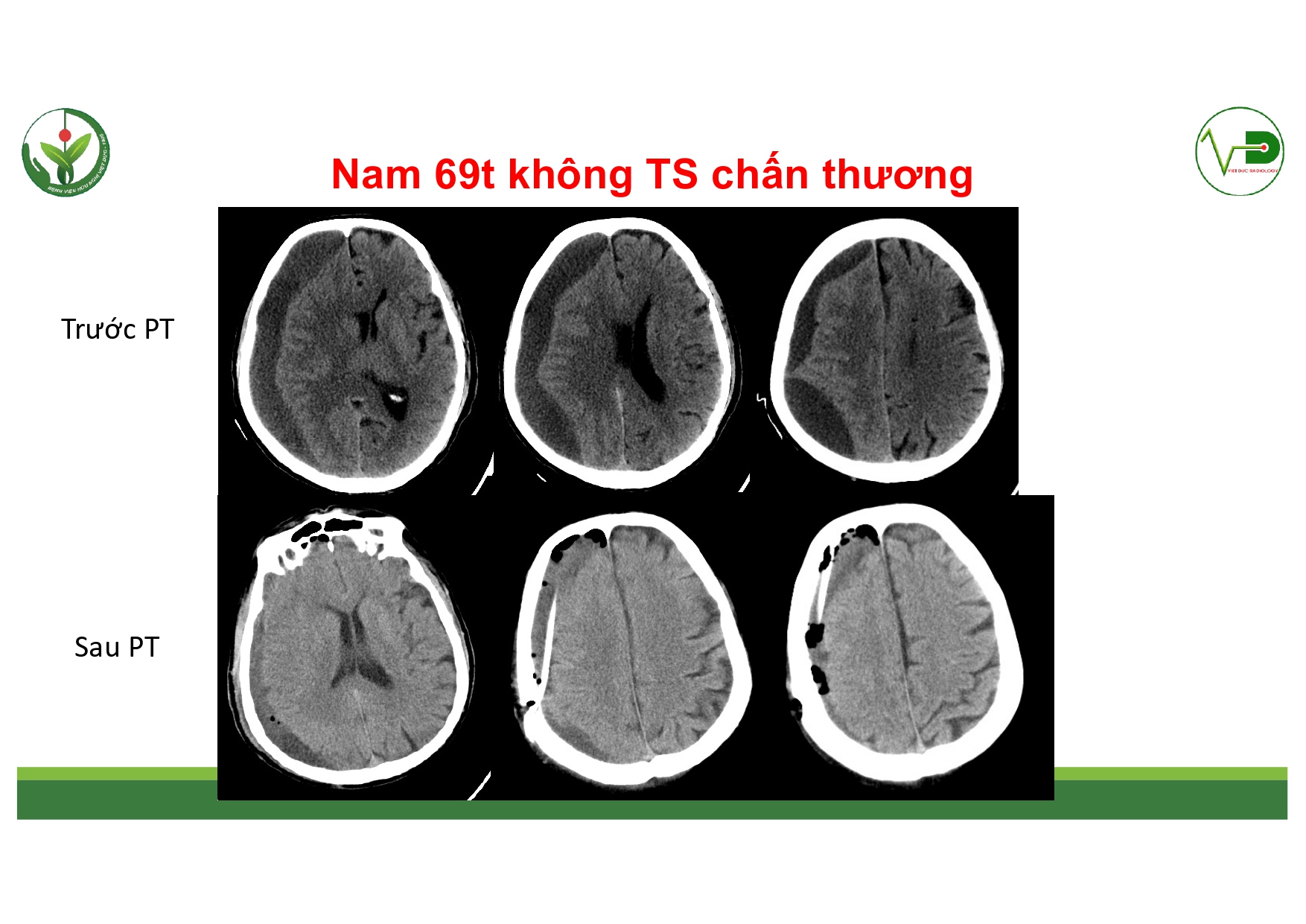 CSDH 4.11.2025 (Lê Thanh Dũng)_page-0030