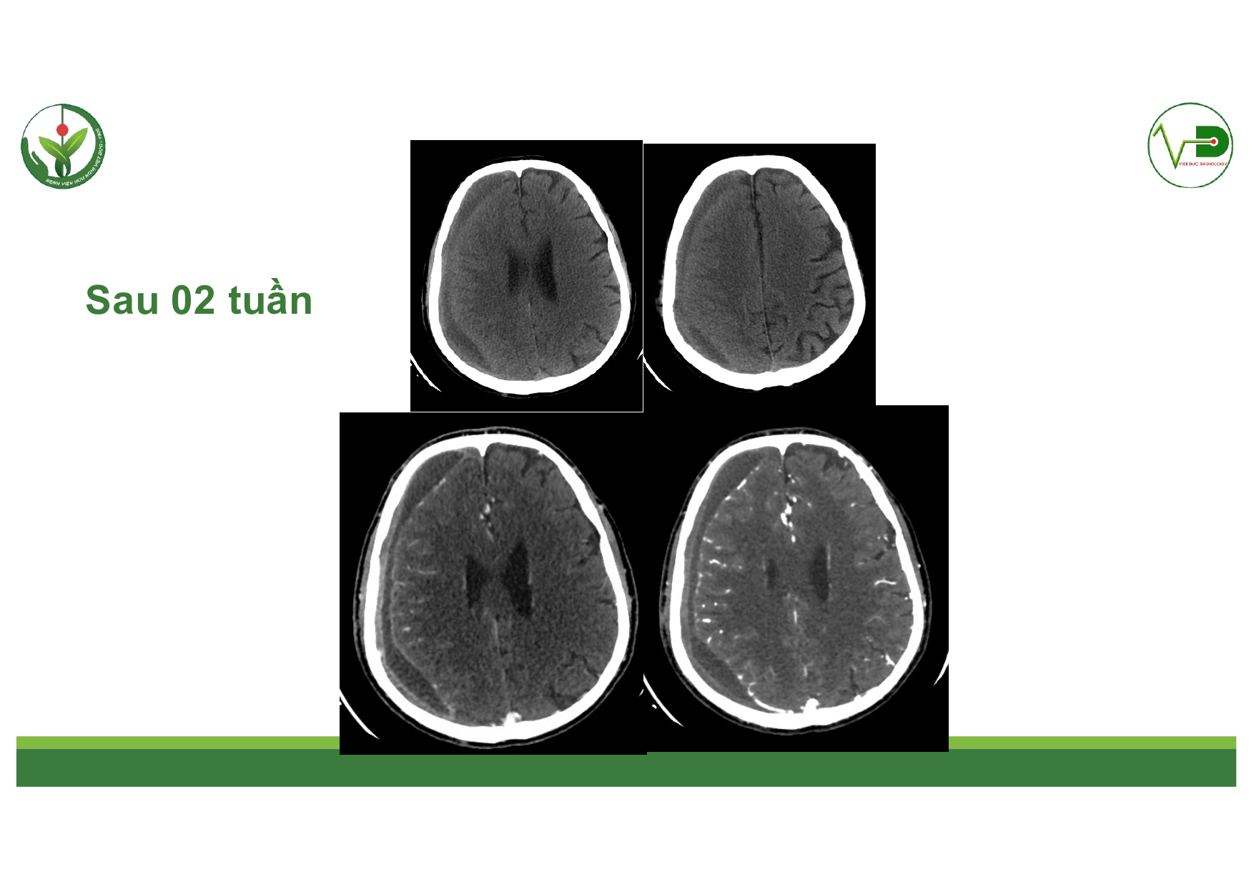 CSDH 4.11.2025 (Lê Thanh Dũng)_page-0031