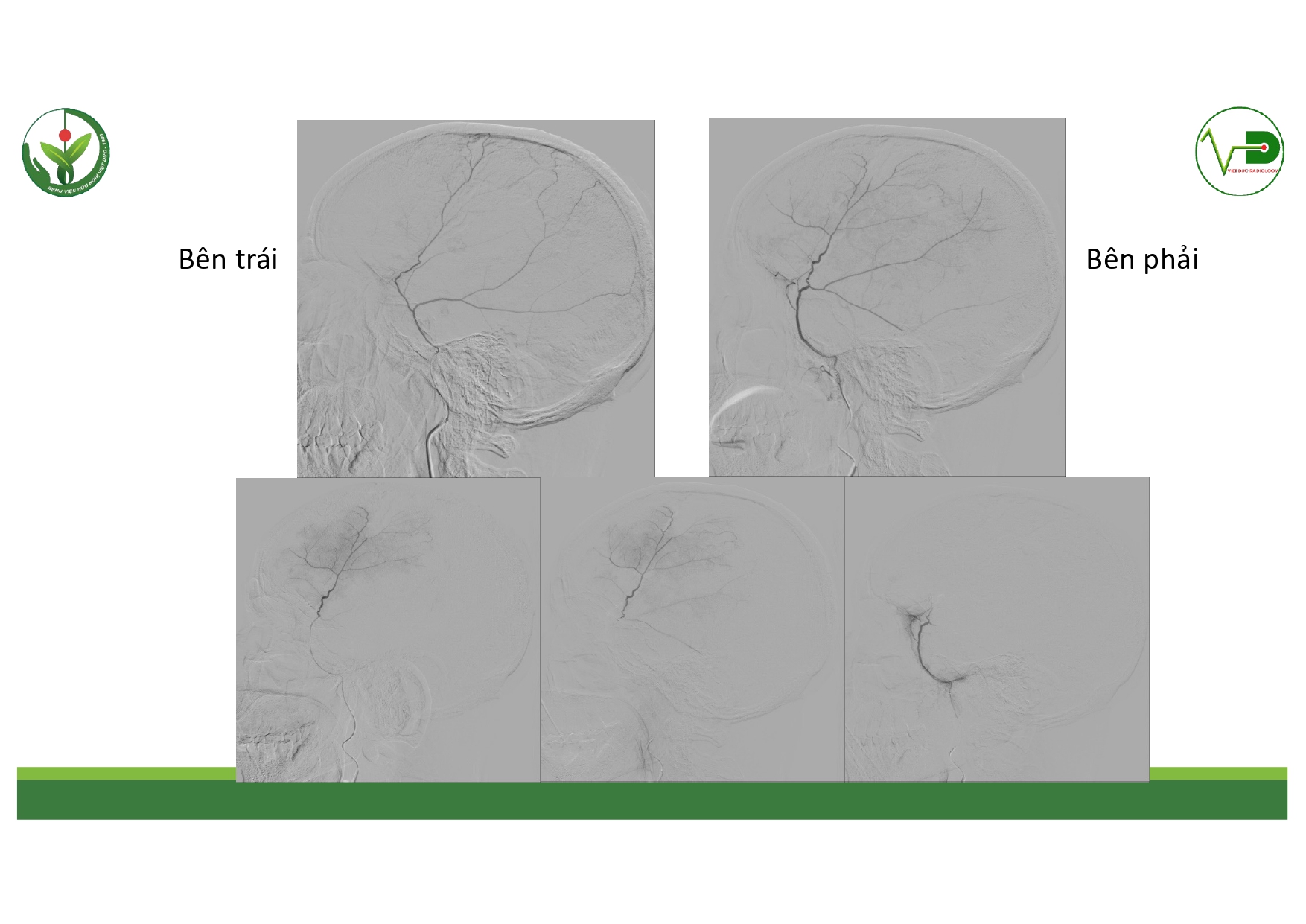 CSDH 4.11.2025 (Lê Thanh Dũng)_page-0032