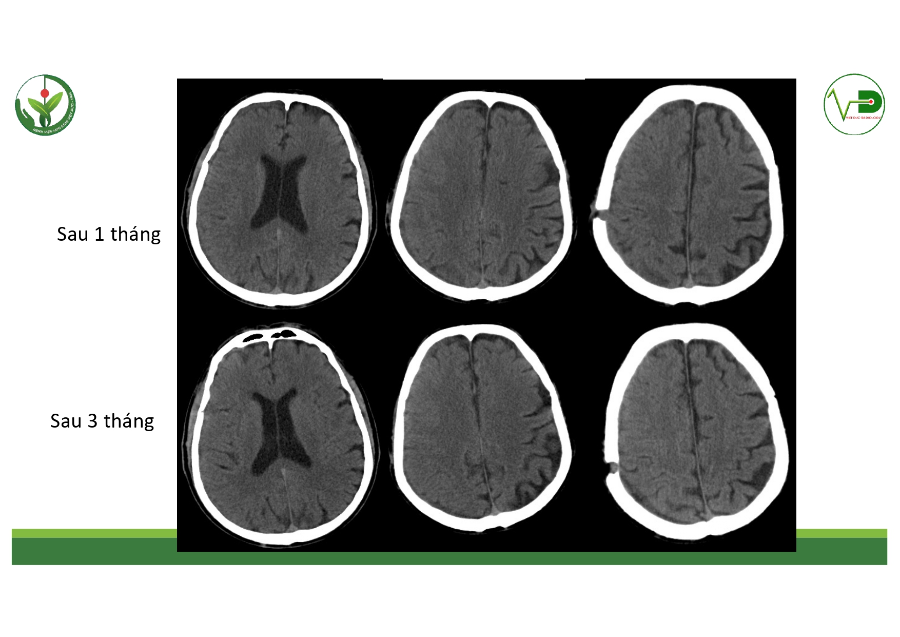 CSDH 4.11.2025 (Lê Thanh Dũng)_page-0033