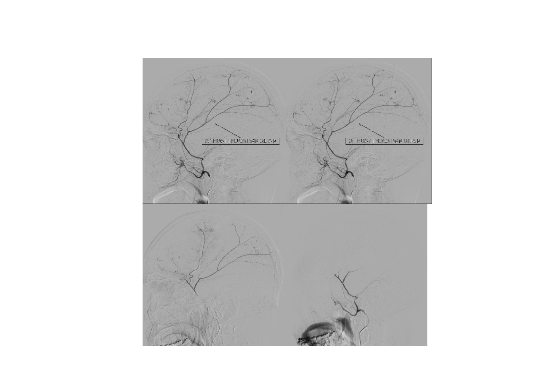 CSDH 4.11.2025 (Lê Thanh Dũng)_page-0036