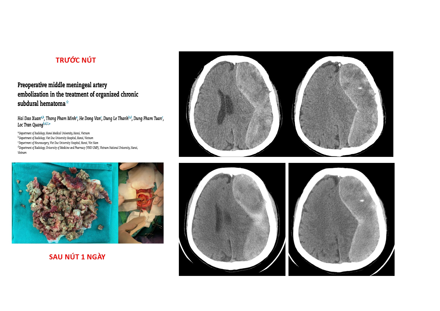 CSDH 4.11.2025 (Lê Thanh Dũng)_page-0037