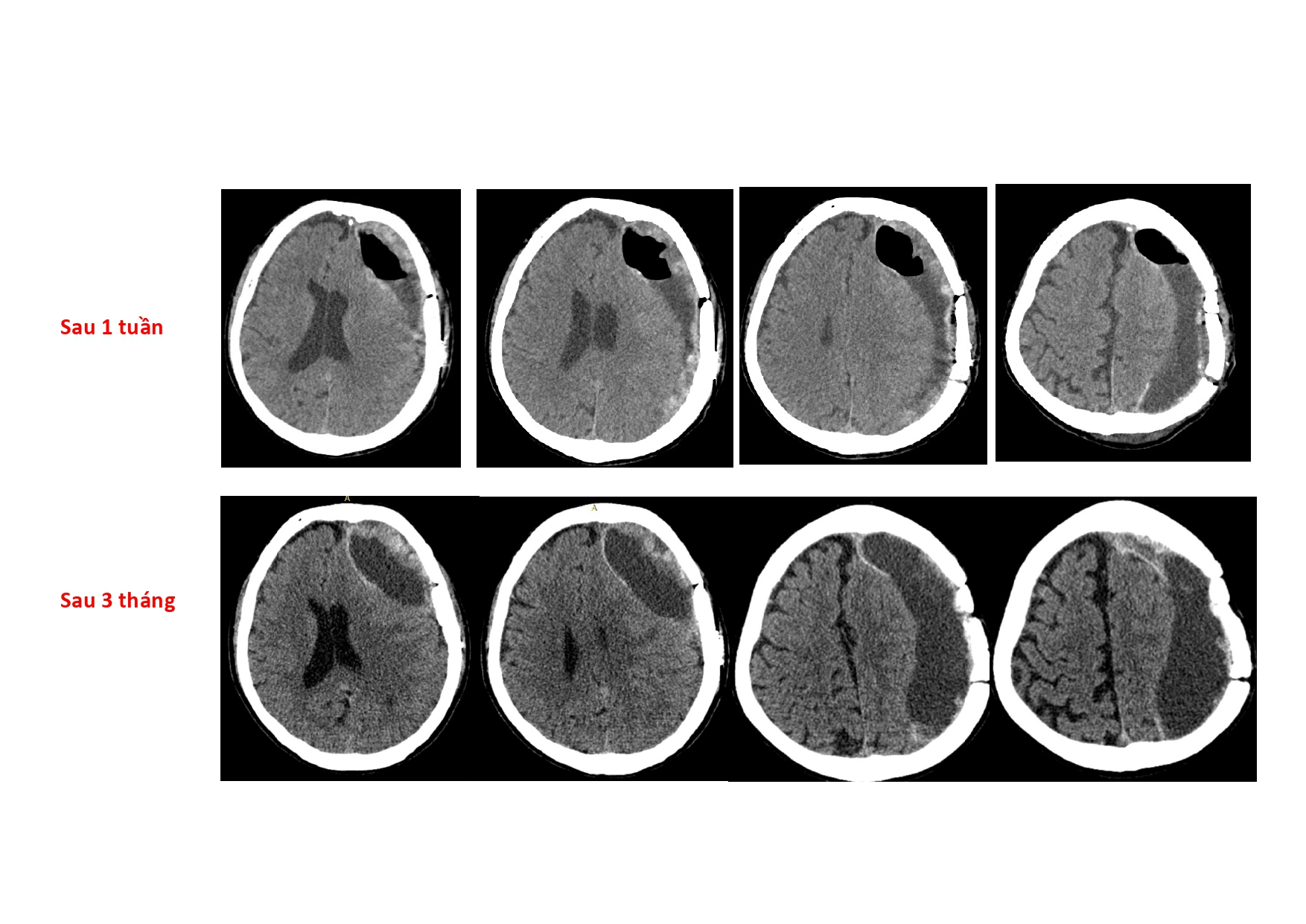 CSDH 4.11.2025 (Lê Thanh Dũng)_page-0038