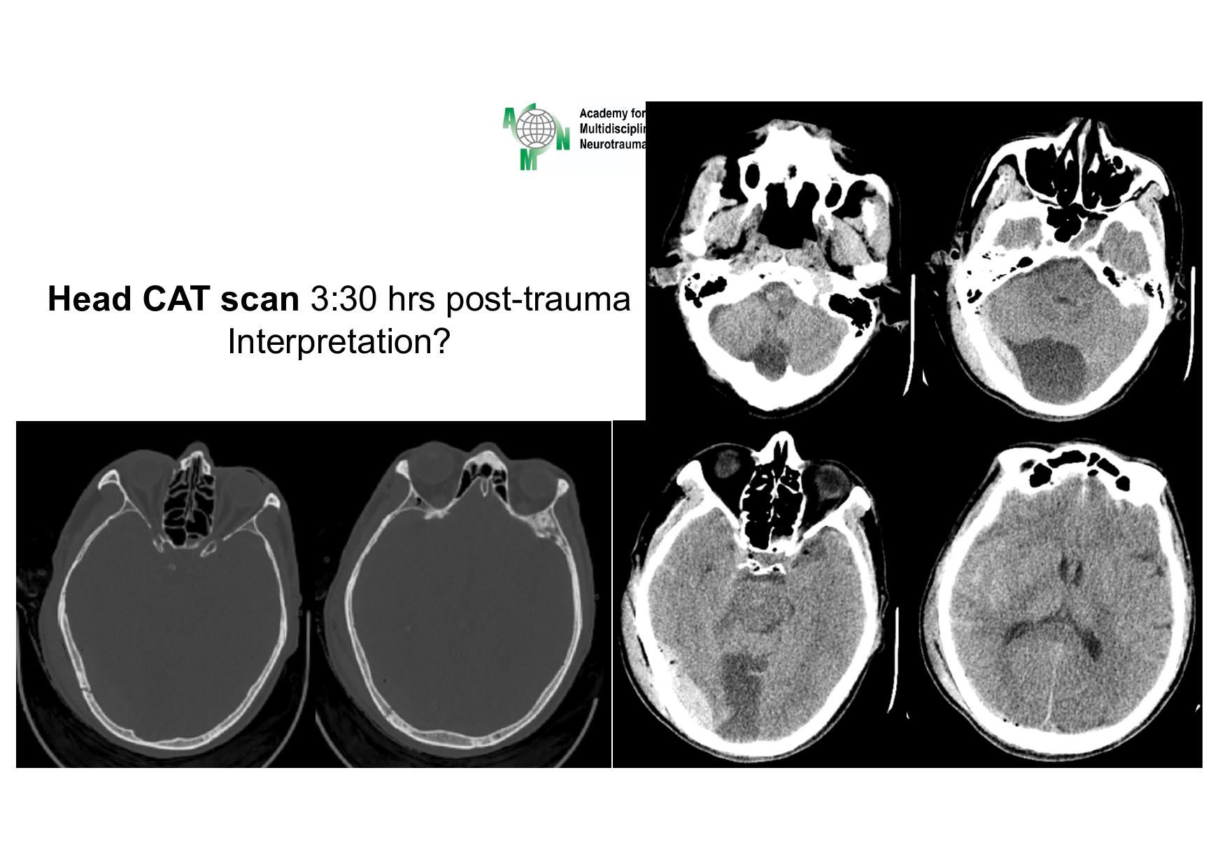 Case presentation_PGS. Ha_page-0006