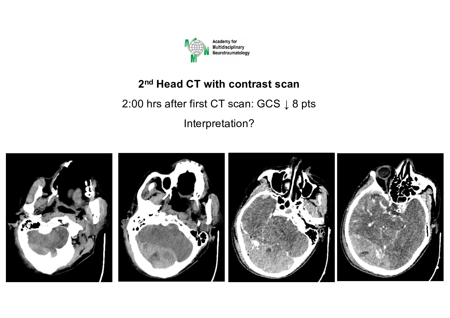 Case presentation_PGS. Ha_page-0010