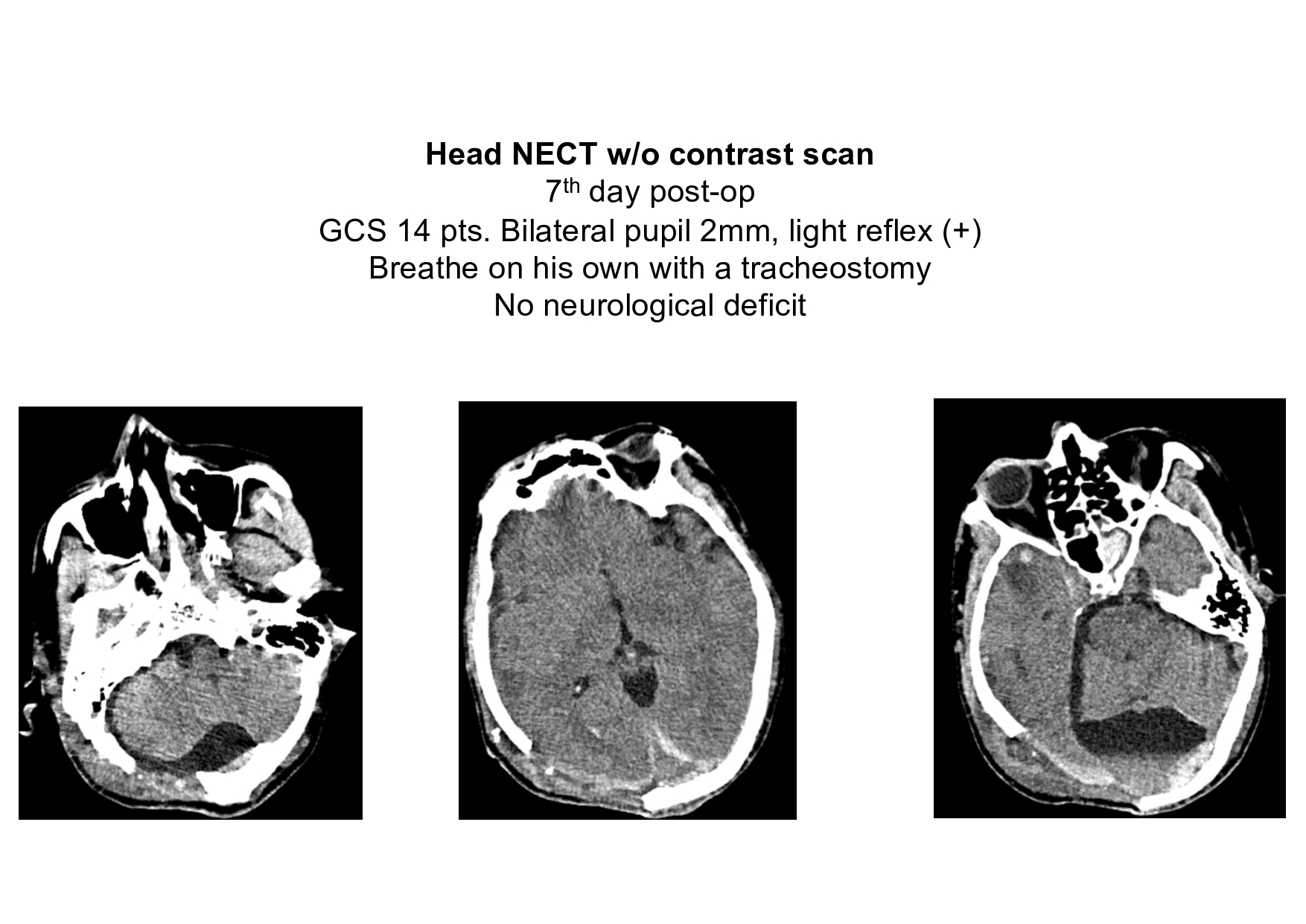 Case presentation_PGS. Ha_page-0013