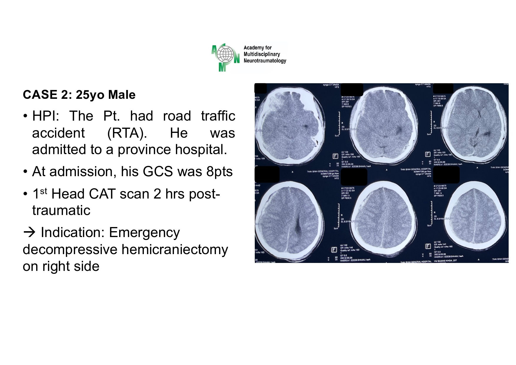 Case presentation_PGS. Ha_page-0014