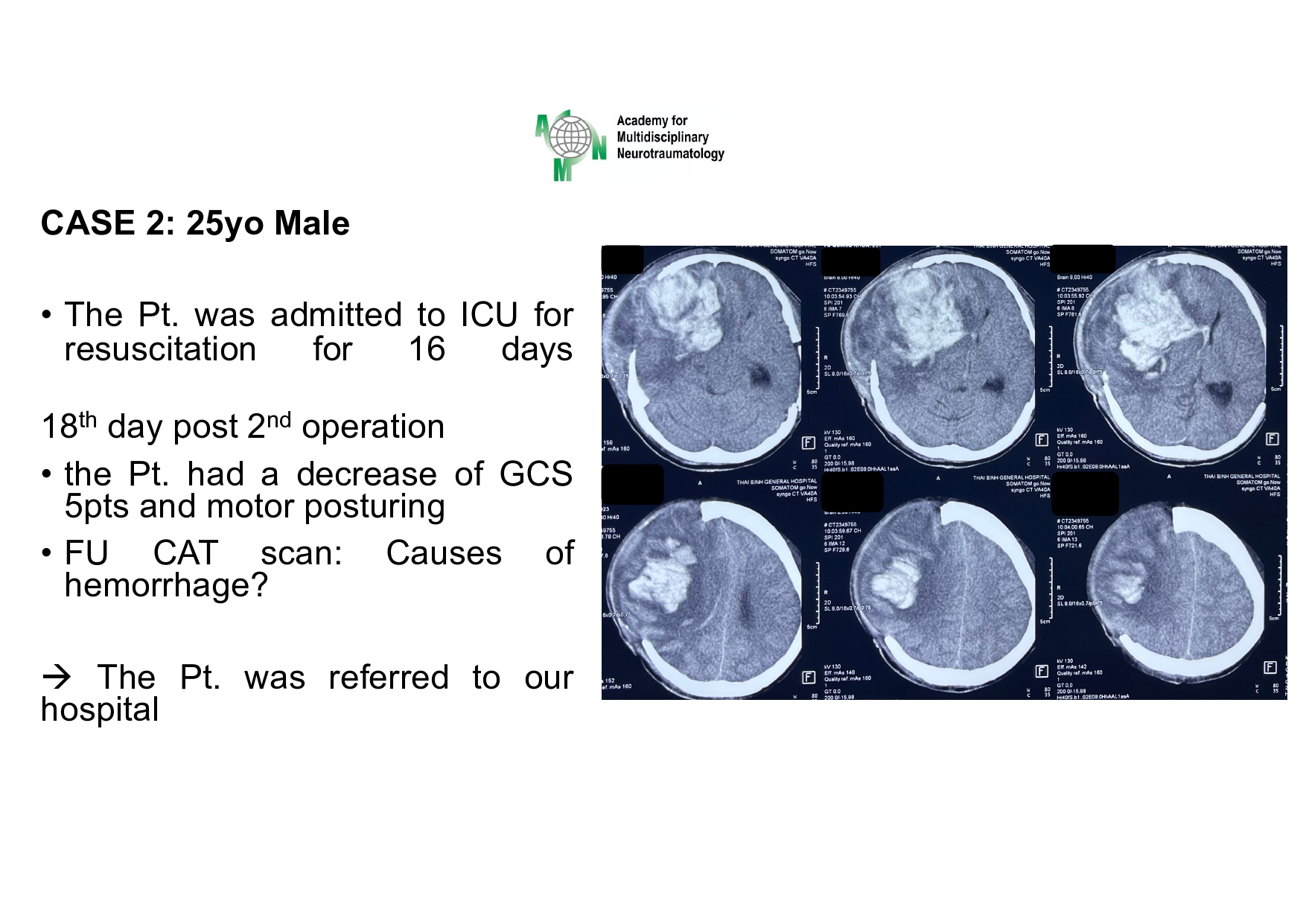 Case presentation_PGS. Ha_page-0021