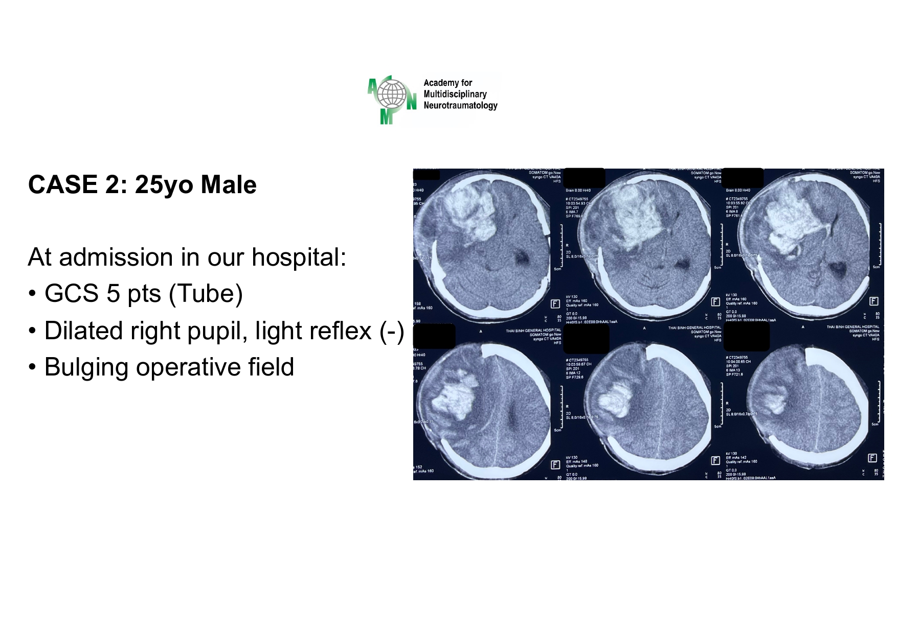 Case presentation_PGS. Ha_page-0022