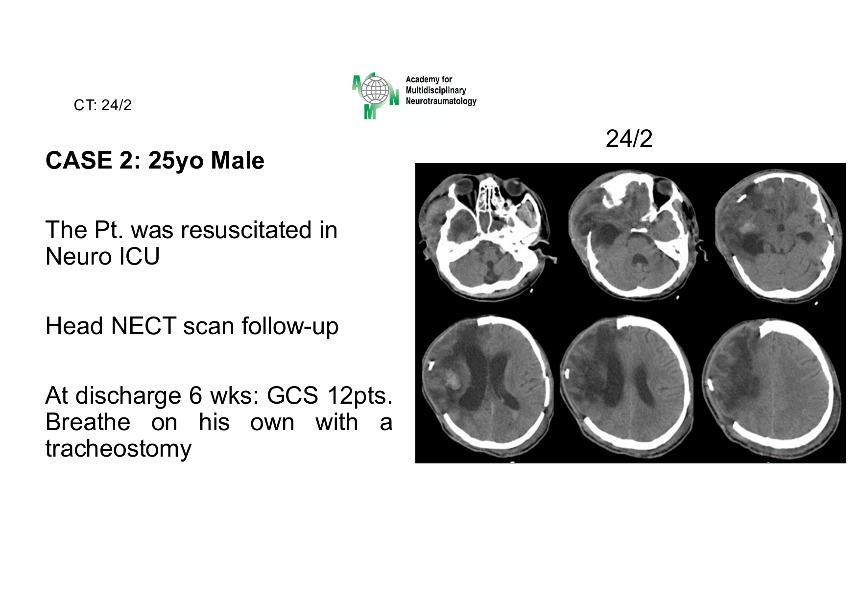 Case presentation_PGS. Ha_page-0025