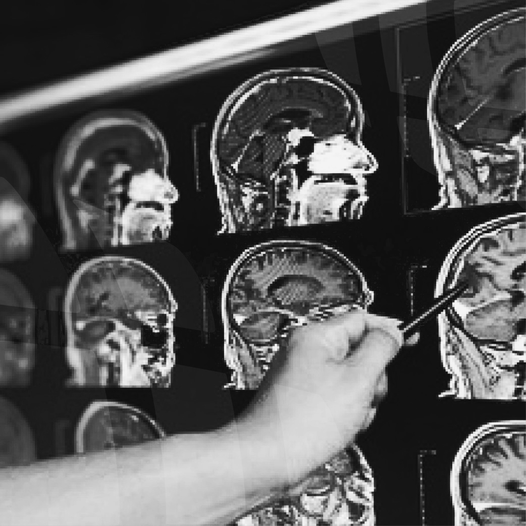 Lack of information flow about patient long-term needs